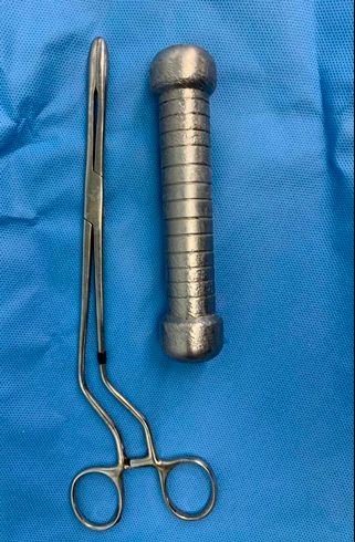 A hombre le hallaron una pesa en el recto 1 A hombre le hallaron una pesa en el recto Un fuerte dolor de estómago, llevó a un hombre a ir de urgencias a un centro asistencial para que un profesional lo atendiera y le medicara algo para calmar la dolencia. Sin embargo, al hacerle estudios, le hallaron una pesa en el recto.