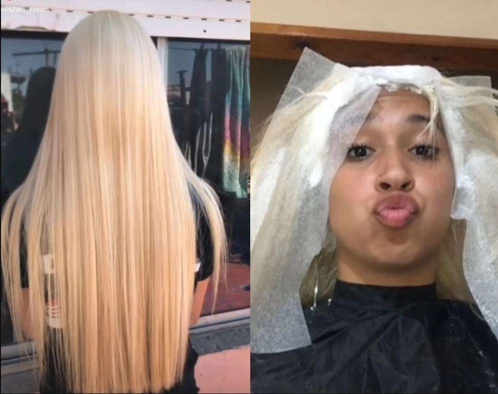En video: Mal procedimiento en peluquería dejó calva a una quinceañera 10 En video: Mal procedimiento en peluquería dejó calva a una quinceañera Shei Rivas es una joven argentina, que se volvió viral en TikTok debido a que le contó a sus seguidores que en vísperas de cumplir sus quince años quedó calva por un procedimiento en su raíz.