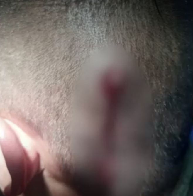 ¡El colmo! Policía fue atracado en Suba 2 ¡El colmo! Policía fue atracado en Suba Un policía en la madrugada de este 4 de abril resultó herido luego de que unos pillos lo abordaran para robarle su celular cuando iba llegando a su casa, en la localidad de Suba.