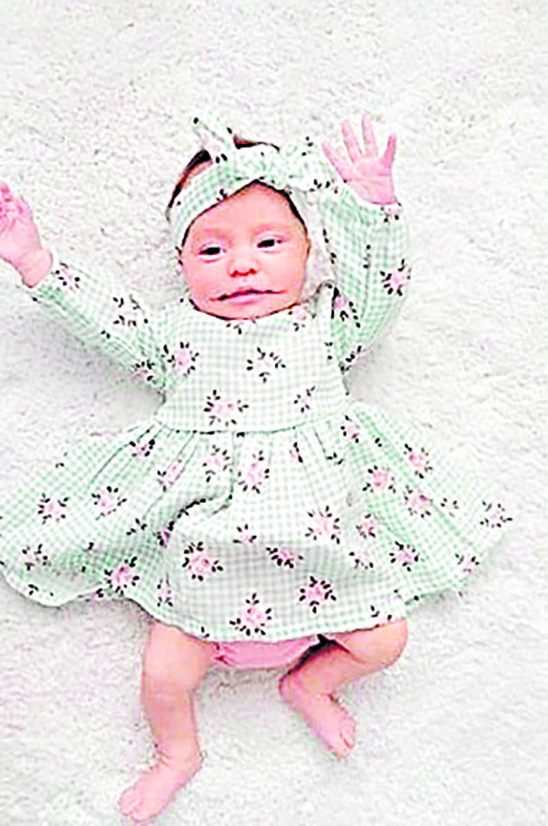 Bebé nace con 'enorme sonrisa' Ayla Summer Mucha nació en diciembre del año pasado con macrostomía bilateral aislada, una condición que le hace lucir su boca más grande de lo normal, como si estuviera sonriendo siempre.