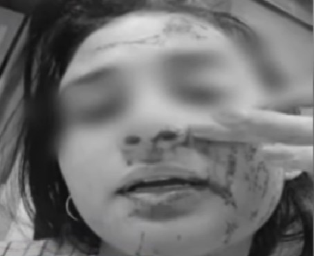 Mujer denuncia que fue brutalmente agredida por un policía 1 Mujer denuncia que fue brutalmente agredida por un policía Valentina hizo la denuncia ante la Fiscalía y espera que el agresor responda por las lesiones que le causó. Además, hizo un llamado para que este miembro de la policía tenga más respeto por las mujeres.