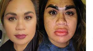 Mujer se mandó a hacer tratamiento en cejas y el resultado fue desastroso 1 Mujer se mandó a hacer tratamiento en cejas y el resultado fue desastroso Cada día son más las personas que les gusta someterse a tratamientos de belleza, lo cual no está nada mal, puesto que preocuparse por uno mismo y querer lucir mejor, hace parte de las decisiones que cada persona toma. Tristemente hay quienes no dan con buenas manos para hacerse algún procedimiento y terminan con resultados nefastos como el de una mujer en Estados Unidos.