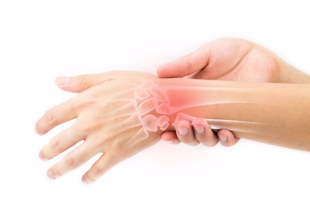 El ejercicio es una buena medicina para el dolor articular La mejor manera de prevenir el dolor articular es mediante la práctica de ejercicio físico de forma regular, un hecho que favorece la movilidad articular, a la vez que fortalece la musculatura.