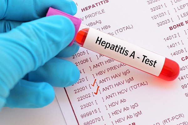 La extraña hepatitis que pone a dudar al mundo 1 La extraña hepatitis que pone a dudar al mundo Autoridades sanitarias de todo el mundo, incluida la Organización Mundial de la Salud (OMS), han venido alertando en los últimos dos meses de un extraño caso de hepatitis nuevo (por cuanto no concuerda con los ya existentes) que ha venido afectando la salud de más de 300 niños a nivel mundial.