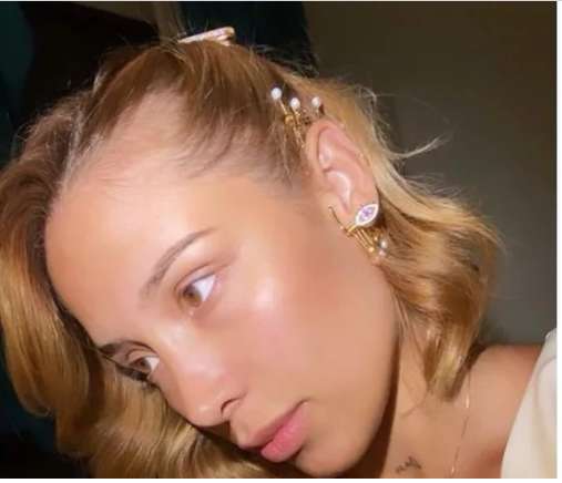 "Antes tengo pelo": Luisa Fernanda W confesó que sufre de alopecia 1 "Antes tengo pelo": Luisa Fernanda W confesó que sufre de alopecia Luisa Fernanda W no deja de sorprender a sus seguidores y ellos a su vez, no dejan de hacerle preguntas y recomendaciones,