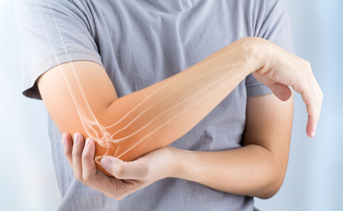 Osteoporosis, un mal de sumo cuidado La osteoporosis es el tipo más común de enfermedad ósea. Esta aumenta el riesgo de romperse un hueso.