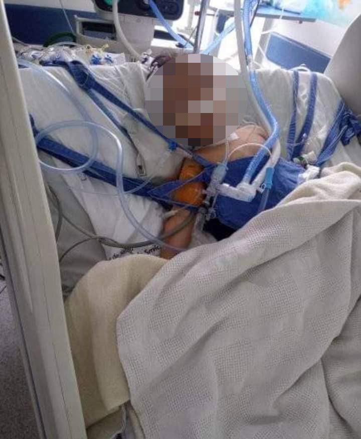 ¡Qué dolor! Bebé murió por fuerte golpiza en Ciudad Bolívar “Mi hermano (el papá del niño) se separó de la mujer (la mamá del niño) y ella insistía en que el niño debía estar con ella. Aún así lo cuidábamos cuando lo necesitaban. Pero lo que pasaba era que muchas veces el niño nos llegaba desnutrido, golpeado y en muy mal estado. Él quería quitarle el niño a esa mujer pero ella no lo permitió. El niño duró 15 días fuera de nuestro cuidado y en ese tiempo fue que pasó toda la tragedia”, señaló ayer Jeni, una de las tías del bebé.