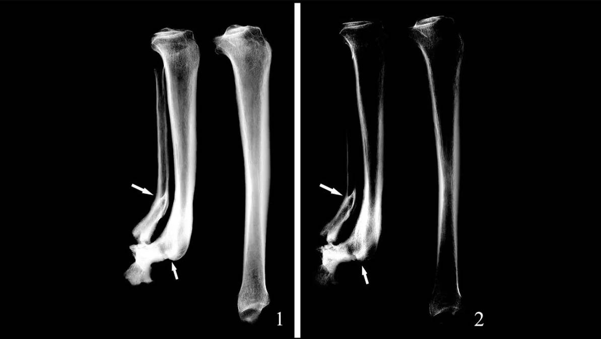 Hallan restos de una mujer amputada hace 3 mil años Investigadores de la Universidad de Pekín (China) hallaron en la provincia de Shaanxi los restos de un ser humano que fue enterrado hace 3 mil años. Según el estudio, los huesos le pertenecían a una mujer de entre 30 y 35 años.