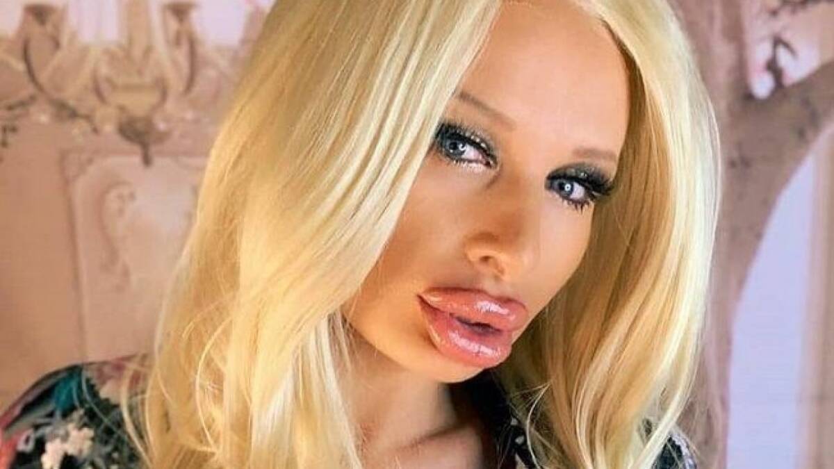 A actriz porno se le explotó un seno y se puso una bolsa de harina Sophie Anderson, una reconocida actriz para adultos, se ha vuelto más conocida después de que confesara el drama que está viviendo con uno de sus implantes de seno.