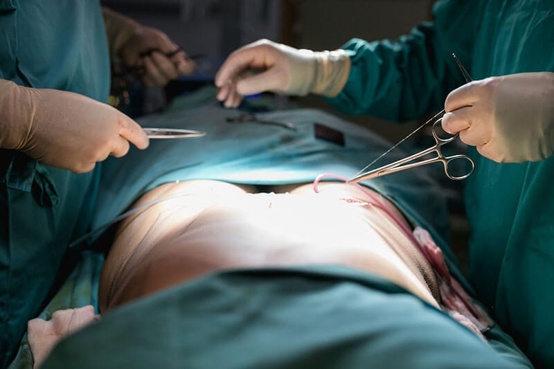 Joven se arrepintió de su cirugía de cambio de sexo tras despertar de la anestesia El joven, quien decidió someterse a una cirugía de cambio de sexo, luego de despertar de la anestesia se arrepintió de dicha decisión.