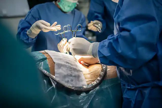 Médicos atendieron cesárea sin luz y cortaron al bebé 3 Médicos atendieron cesárea sin luz y cortaron al bebé Una mujer se dirigió a la Clínica Internacional de Especialidades en Mexicali, México, para dar a luz a su primer bebé por una cesárea ya programada.