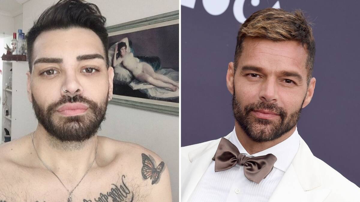¡Impresionante! Se realizó más de 30 cirugías para parecerse a Ricky Martín Tras ese triunfo, Ibañéz sintió que su parecido con Ricky Martin crecía, por lo que decidió realizarse más de 30 cirugías para verse igual al cantante puertorriqueño.