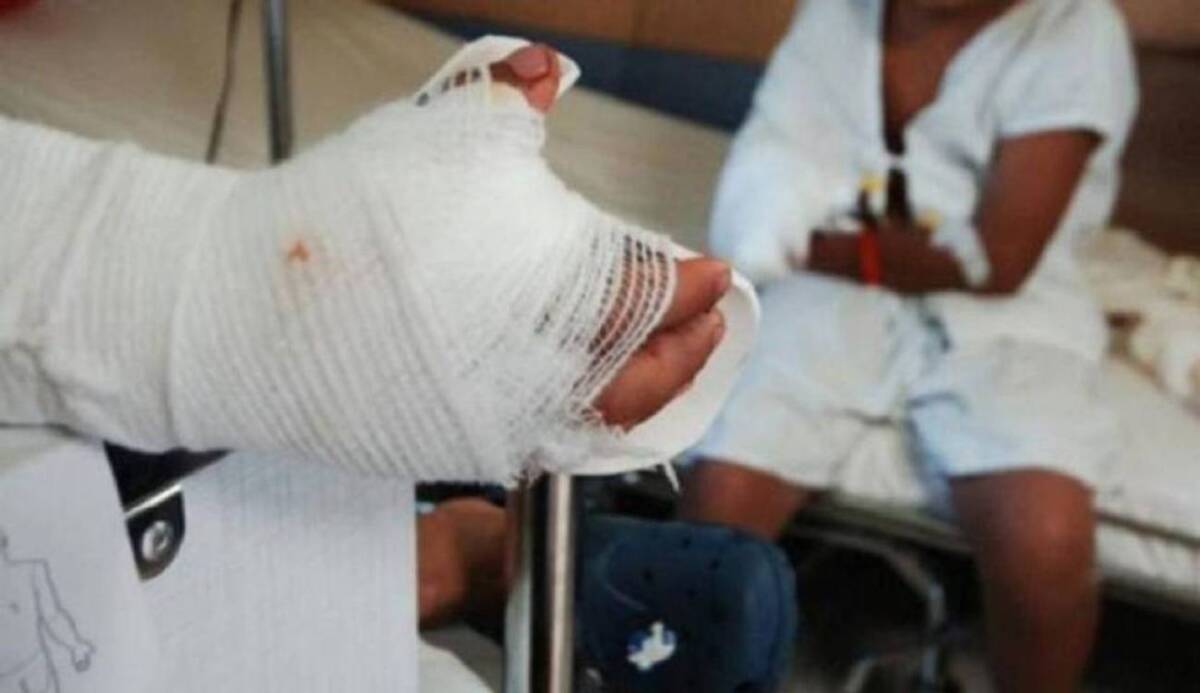 Le quemó las manos a sus hijos por 4 mil pesos 4 Le quemó las manos a sus hijos por 4 mil pesos En las últimas horas se conoció un grave caso de maltrato contra dos menores en Neiva, Huila. Allí un hombre de 32 años quemó las manos de sus hijos por 4 mil pesos que se le habían extraviado.