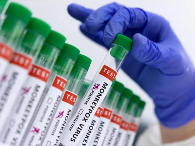 OMS confirmó 2.103 casos de viruela del mono en 42 países La Organización Mundial de la Salud (OMS) ha informado que, hasta el 15 de junio, se han notificado un total de 2.103 casos confirmados de viruela del mono en laboratorio y un caso probable, incluido un fallecimiento en Nigeria, en 42 estados miembros de cinco regiones de la OMS.