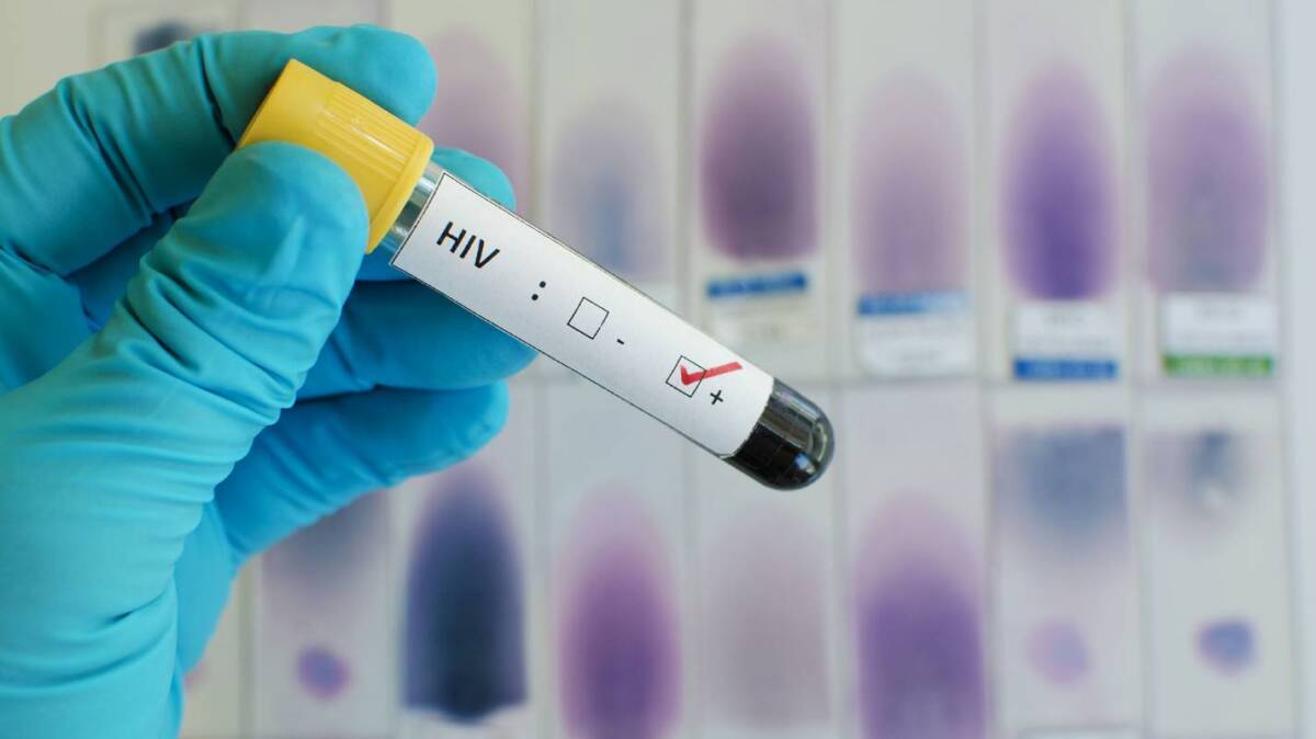 Hombre de 66 años se cura del VIH ¡Es la cuarta persona en el mundo! El hombre que vivió con el virus desde la década de 1980, recibió un tratamiento para tratar la leucemia, mismo que lo habría curado del VIH.