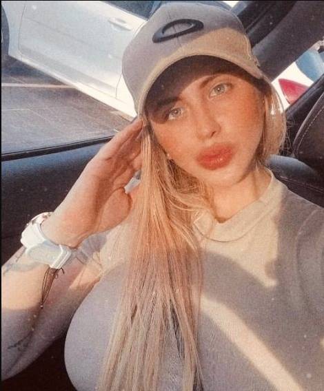 Bella mujer murió tras practicarse una cirugía plástica Michel, de 22 años de edad, falleció en Cali después de realizarse un procedimiento quirúrgico estético. De acuerdo a las declaraciones entregadas por sus familiares, la mujer se realizó una lipoescultura y una intervención sus glúteos.