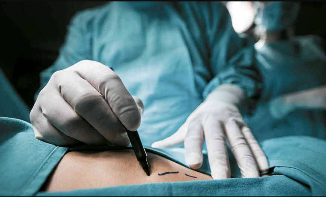 Mujer trans murió tras dudoso procedimiento en Bogotá El pasado sábado se presentó un lamentable deceso que involucra a una joven transgénero que, al parecer, luego de que asistiera a un establecimiento donde realizan supuestos tratamientos estéticos en el que le habrían inyectado una sustancia, hasta ahora desconocida, su cuerpo entró en crisis y tuvo que ser ingresada a un centro asistencial donde lamentablemente falleció.