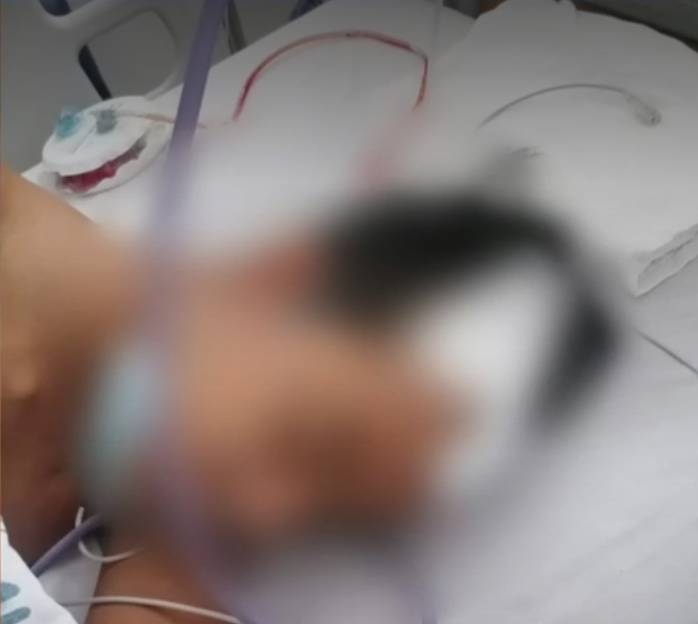 Niño en Bogotá víctima de Bullying se encuentra en un hospital Los casos de Bullyin en los colegios mantiene en alerta a las autoridades y a los padres de familia, cada día son más las denuncias que se conocen por esta grave situación. Recientemente un niño de tan solo 12 años fue víctima de dos compañeros que lo agredieron y terminaron enviándolo al hospital.
