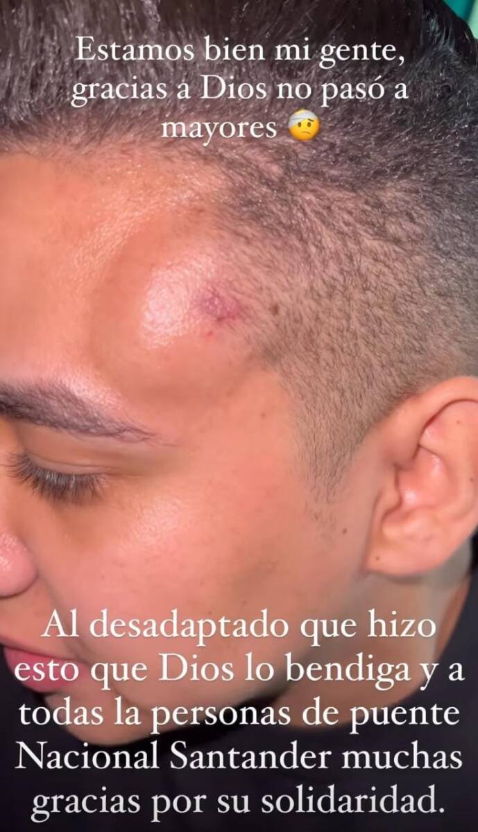 Ana del Castillo se emberracó porque agredieron a su acordeonero 3 Ana del Castillo se emberracó porque agredieron a su acordeonero La cantante de vallenato Ana del Castillo, de 23 años, se enfureció cuando en plena presentación le lanzaron un objeto a su acordeonero en la cabeza.