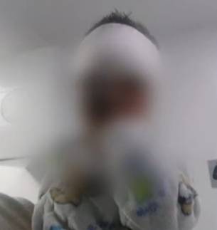 Perro atacó brutalmente a un niño de dos años en un parqueadero de Bogotá Un pequeño niño de solo dos años fue brutalmente atacado por un perro en su rostro y cuerpo, el menor permanece en observación médica y a la espera de varias intervenciones quirúrgicas.