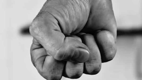 Consternación en Cedritos por un hombre que quedó en coma tras una golpiza Un adulto mayor que cuidaba carros en el barrio Cedritos, del norte de la capital, se encuentra en coma inducido tras haber sido víctima de una brutal golpiza por parte de unos sujetos que lo agredieron sin piedad.