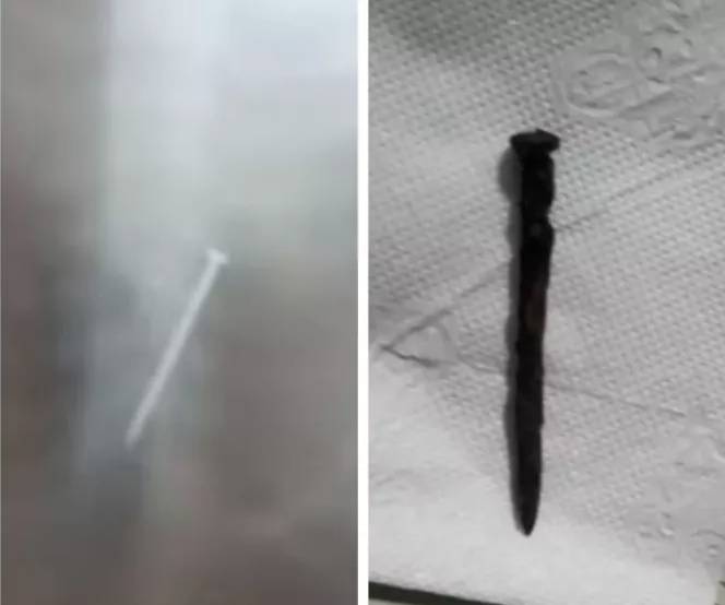 Niño falleció tras durar un año con una puntilla en un pulmón Al ver la compleja situación de Salvador, los médicos decidieron operarlo, pero el pronóstico era desalentador, pues la puntilla había causado daños en el pulmón y tras dos días en cuidados intensivos, falleció.