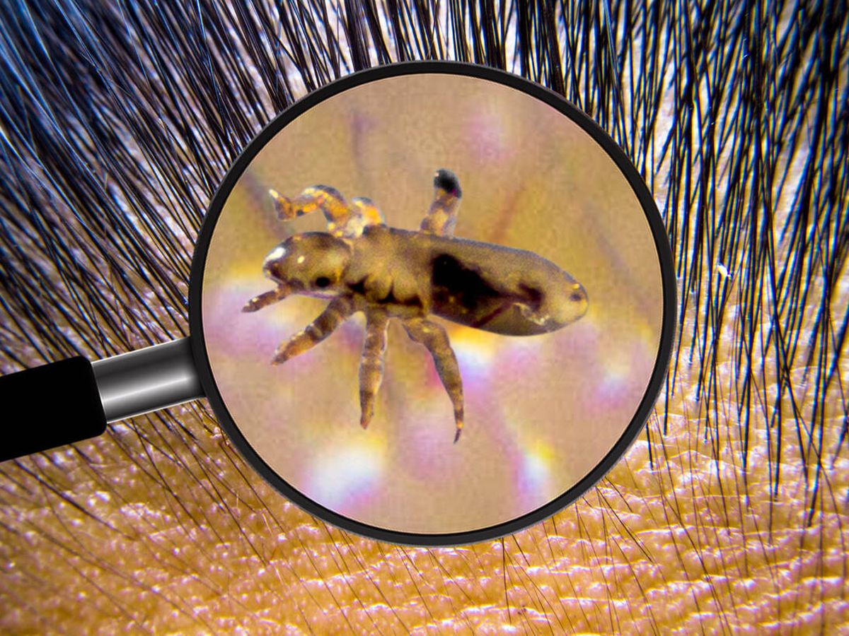 Los piojos, unos animalitos muy incómodos Los piojos son pequeños insectos que viven en las cabezas de las personas y se alimentan de la sangre humana. Los piojos adultos pueden llegar a medir entre dos y tres milímetros de largo y ponen sus huevos en el cuero cabelludo. No obstante, también pueden aparecer piojos en el vello púbico, las pestañas y las cejas, aunque lo más habitual es encontrarlos en la cabeza.