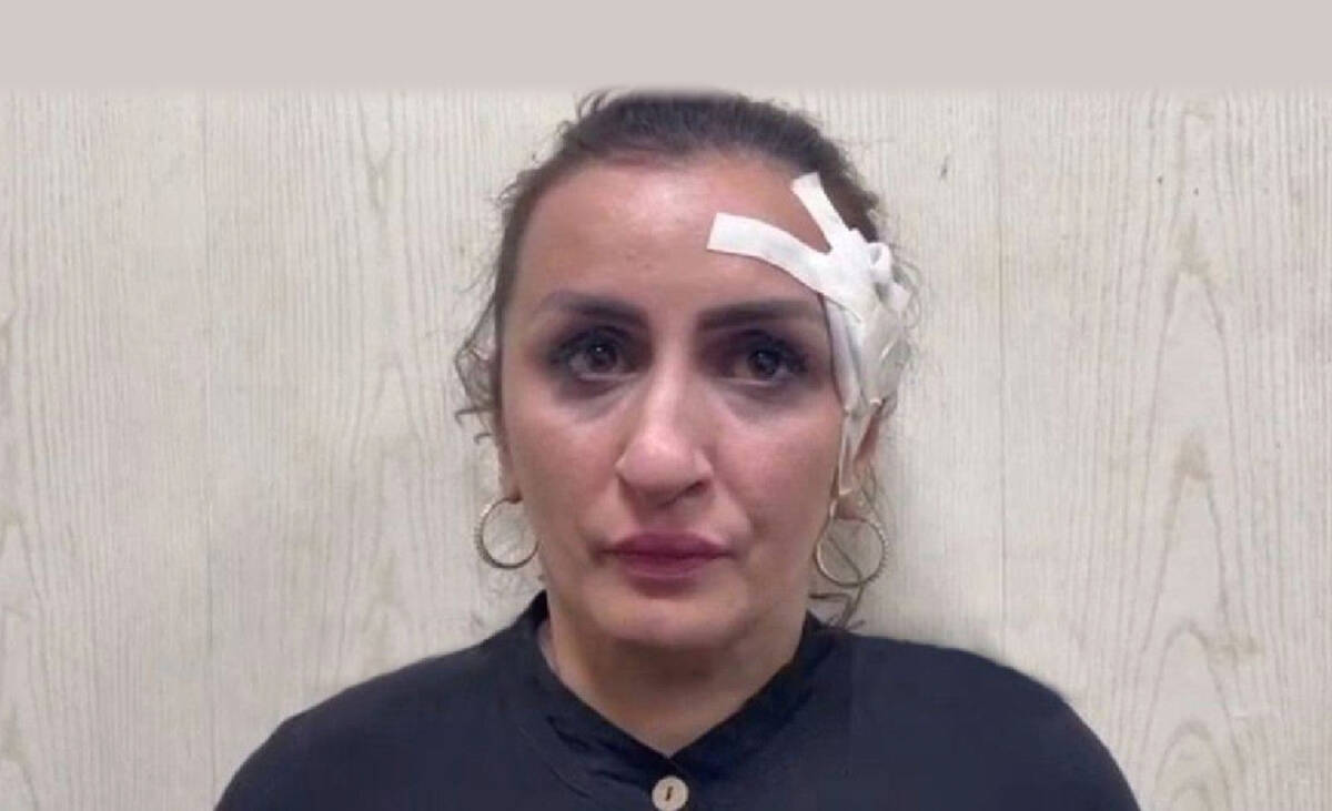 Mujer vendió a su bebé para hacerse una rinoplastia Una mujer de 33 años fue capturada por el delito de trata de menores, luego de que las autoridades descubrieran que había vendido a un bebé de cinco días de nacido. Tras su aprehensión, la acusada confesó que el bebé que vendió era suyo.