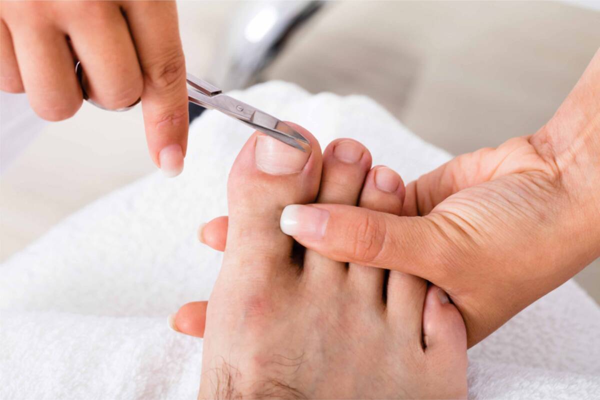 Los dolorosos uñeros Habitualmente se localiza alrededor de las uñas, en su unión con la piel. Se producen pequeñas heridas en el ángulo de la piel que cubre la base de la uña, normalmente por alguna deficiencia a la hora de cortarla.