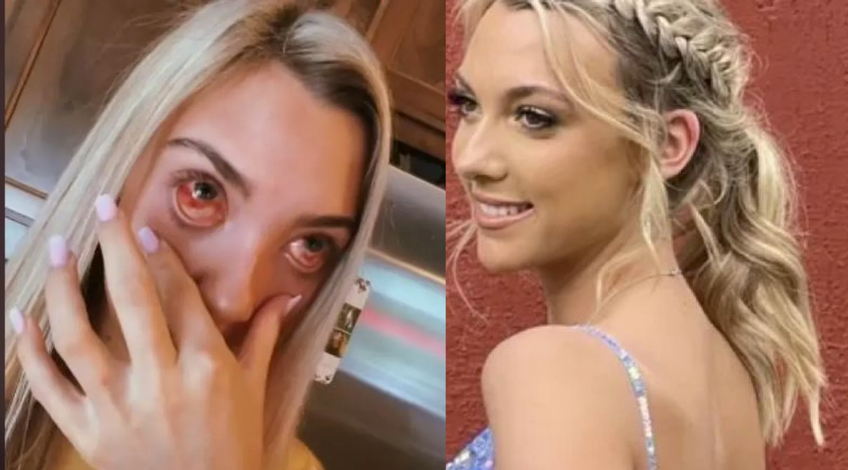 Mujer que se puso pestañas terminó con una terrible infección en los ojos Hacerse extensión de pestañas se ha vuelto cada vez más popular para hacer resaltar más la mirada, pero no siempre estos procedimientos resultan de la mejor manera, o al menos eso lo puede afirmar una mujer que terminó con una terrible alergia en los ojos.