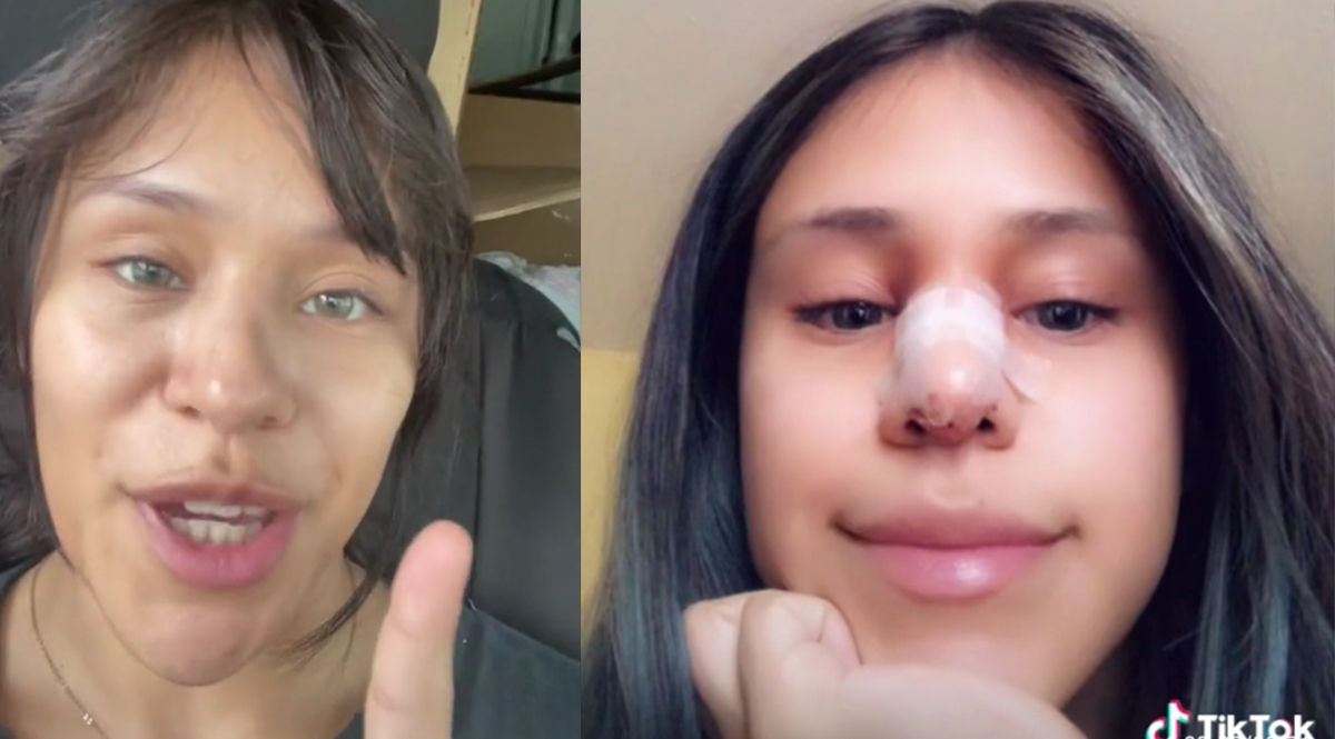 Perdonó infidelidad de su novio a cambio de que le pagara una cirugía estética La infidelidad es un tema que no muchas personas perdonarían, pero una joven buscó la forma de sacarle provecho a la situación y dejarla pasar a cambio de una cirugía estética.