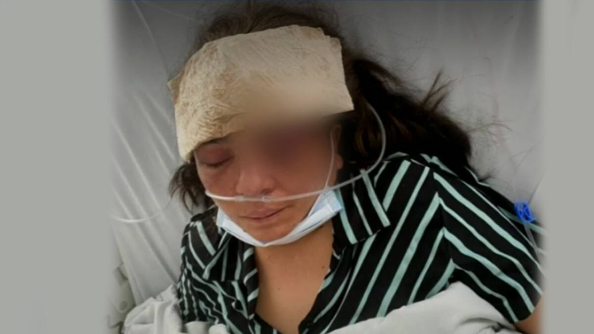 Hombre que atacó brutalmente a su esposa quedó libre 9 Hombre que atacó brutalmente a su esposa quedó libre Leer también: Video: Delincuente encañonó a hombre y le quitó $20 millones
