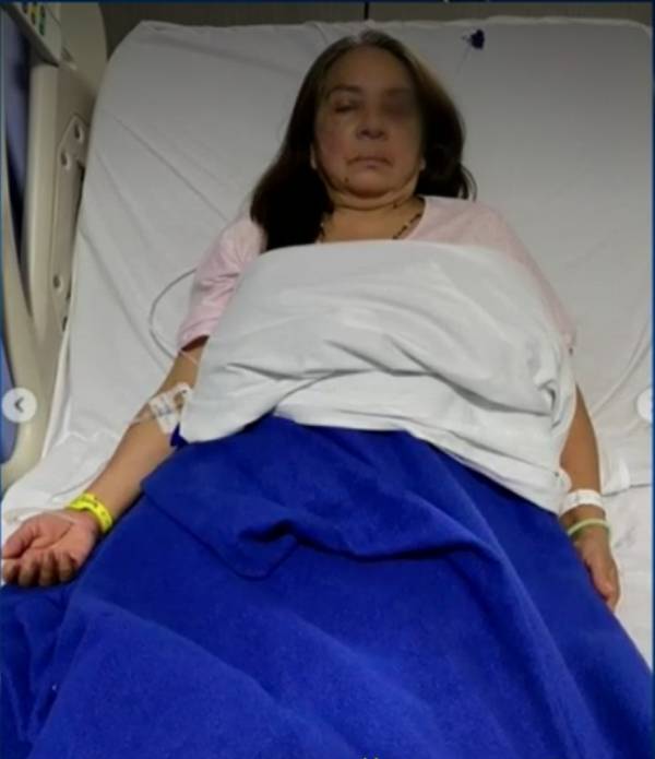 Hombre que atacó brutalmente a su esposa quedó libre 1 Hombre que atacó brutalmente a su esposa quedó libre Leer también: Video: Delincuente encañonó a hombre y le quitó $20 millones