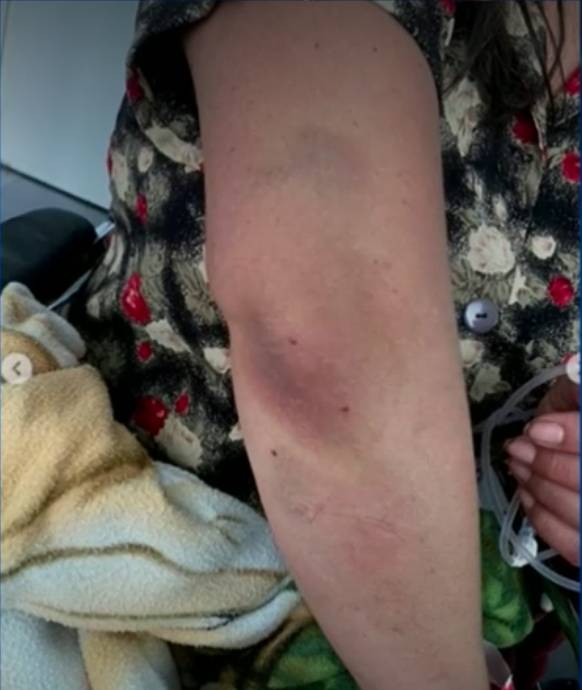 Hombre que atacó brutalmente a su esposa quedó libre 3 Hombre que atacó brutalmente a su esposa quedó libre Leer también: Video: Delincuente encañonó a hombre y le quitó $20 millones