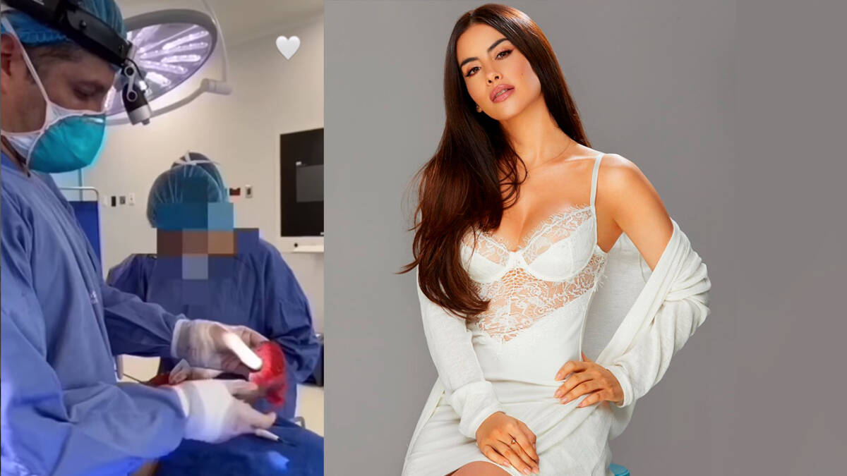 VIDEO: Cediel mostró las imágenes de cómo quedó su cola por biopolímeros 7 VIDEO: Cediel mostró las imágenes de cómo quedó su cola por biopolímeros A post shared by Jessica Cediel (@jessicacedielnet)