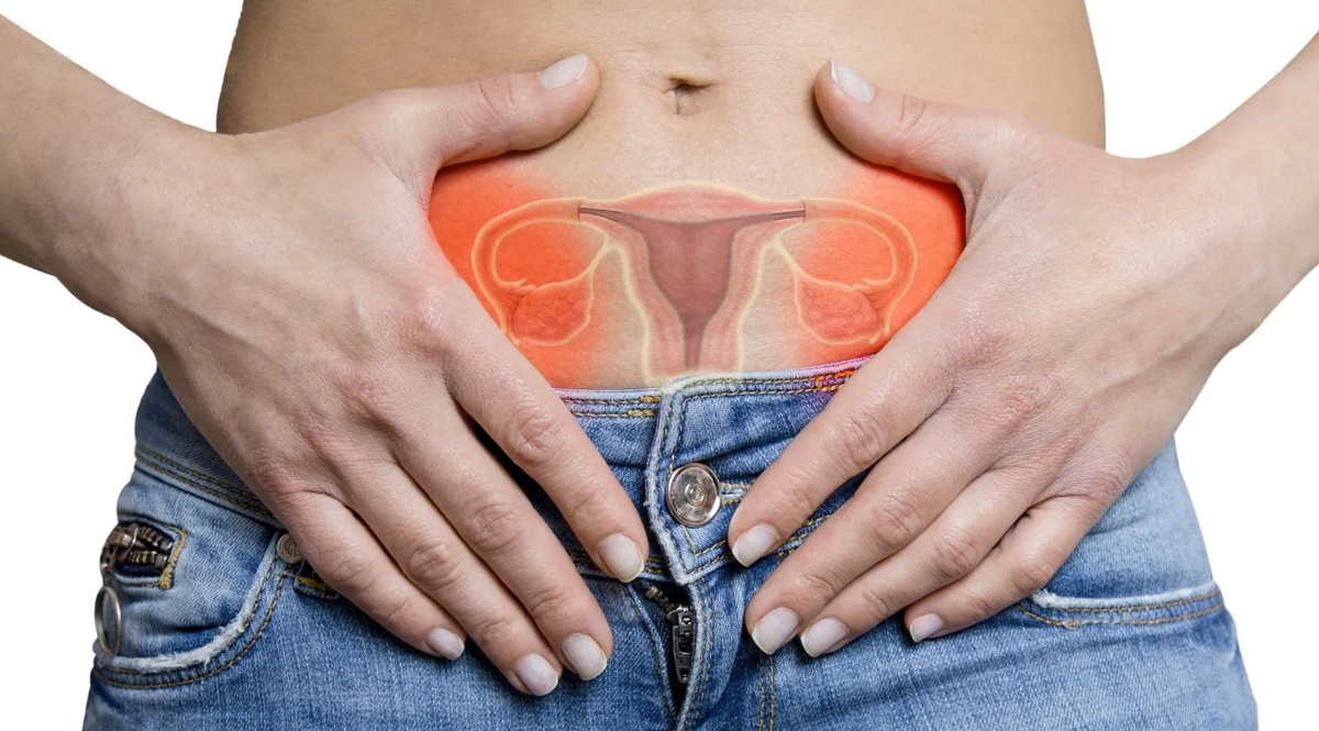 Quistes Ováristicos Los quistes ováricos son sacos o bolsas llenos de líquido en un ovario o en su superficie. Las mujeres tienen dos ovarios; cada uno tiene el tamaño y la forma de una almendra y está ubicado a un lado del útero. Los óvulos (huevos), que se producen y maduran en los ovarios, se liberan en ciclos mensuales durante los años fértiles.