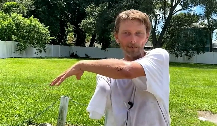 Hombre sobrevivió tres días sin un brazo luego de perderlo por un caimán Un hombre duró tres días perdido en un pantano y sin un brazo, pues luego de extraviarse decidió cruzar un lago donde se encontró con un caimán en Myakka City, Florida, Estados Unidos.