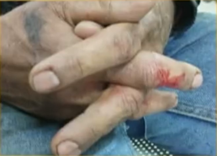 Brutal e infame golpiza a domiciliario en Cedritos Un domiciliario fue víctima de una brutal golpiza que lo dejó con un trauma craneoencefálico. El hecho ocurrió en el barrio Cedritos, norte de Bogotá.