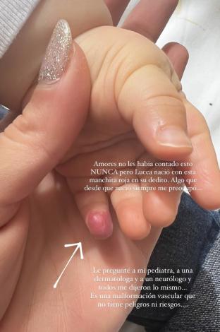 Laura Tobón habló sobre la malformación que tiene su hijo 1 Laura Tobón habló sobre la malformación que tiene su hijo La presentadora y modelo Laura Tobón, se convirtió en madre en diciembre del año pasado y desde entonces, ha compartido toda su vida con esta nueva faceta en redes sociales.