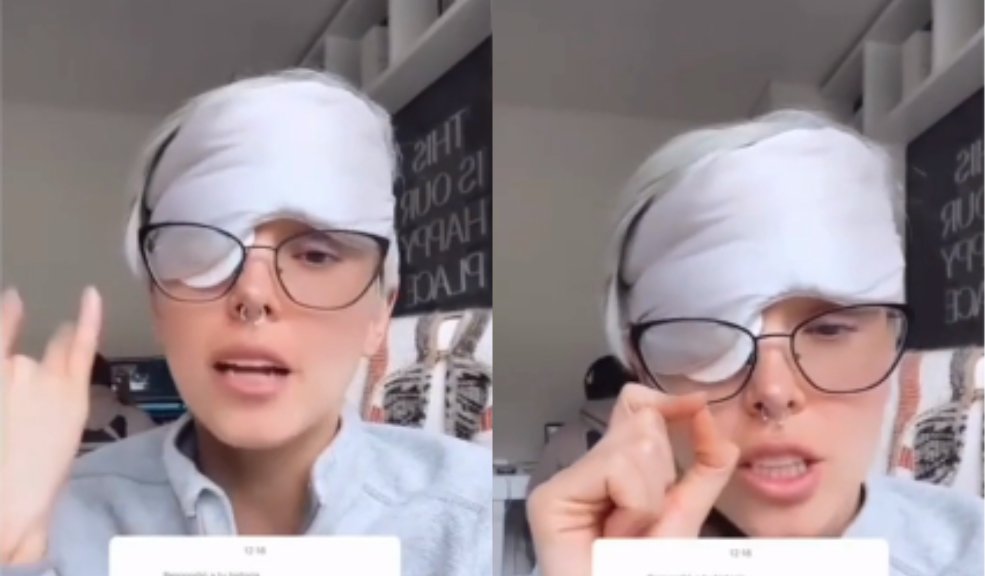 Kika Nieto reveló cómo descubrió el tumor en su ojo 6 Kika Nieto reveló cómo descubrió el tumor en su ojo “Anoche me empezó a molestar otra vez y amaneció feo, feo”, dijo la youtuber Kika Nieto a través de sus redes sociales, donde actualizó a sus seguidores sobre su estado de salud, lo que generó preocupación.