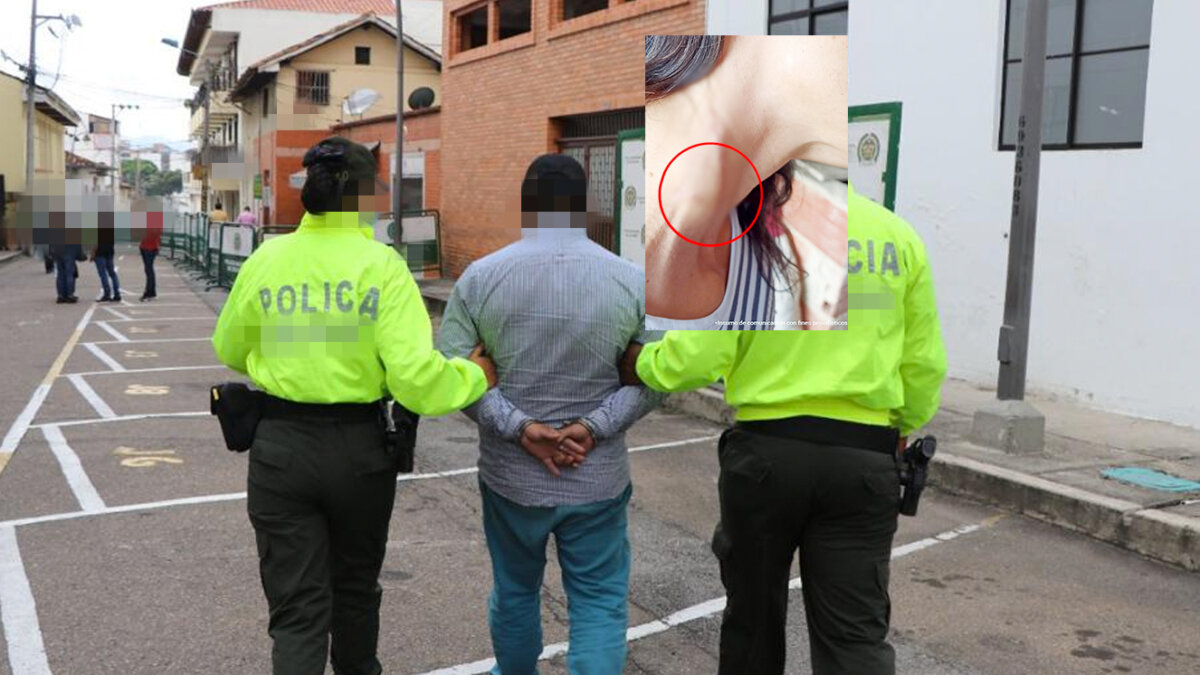 Le dan cárcel a sujeto que agredió a su ex y le amputó dos dedos Tras recaudar un importante acerbo probatorio, un fiscal de la Seccional Cundinamarca le imputó al señalado el delito de feminicidio agravado en grado de tentativa y pidió que Gil Gómez fuera cobijado con medida de aseguramiento en centro carcelario. El hombre tendrá que responder por sus actos en la Cárcel Nacional Modelo de Bogotá.