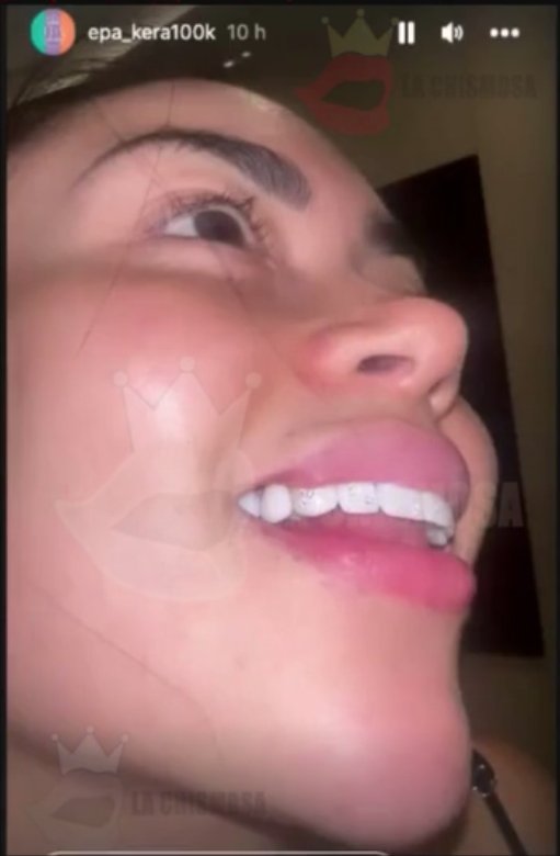 La nueva excentricidad de 'Epa Colombia': se puso diamantes en los dientes 1 La nueva excentricidad de 'Epa Colombia': se puso diamantes en los dientes La empresaria de keratinas 'Epa Colombia', que ha sido noticia estos días por la demanda que le metió su expareja, Diana Celis, volvió a acaparar la atención de sus seguidores y detractores tras compartir en sus historias de Instagram el "arreglito" que le hizo a su diseño de sonrisa.