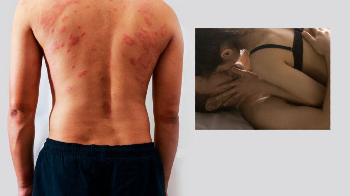 ¡De no creer! Hombre es alérgico a los orgasmos El “hombre más desafortunado del mundo”, así fue catalogado un hombre de 27 años que es alérgico a los orgasmos.
