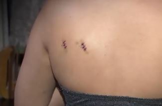 Joven fue apuñalada en atraco masivo de TransMilenio El más reciente caso de violencia dentro de un articulado de TransMilenio, dejó una joven herida, pues terminó con dos puñaladas en la espalda por resistirse a entregar sus pertenencias.