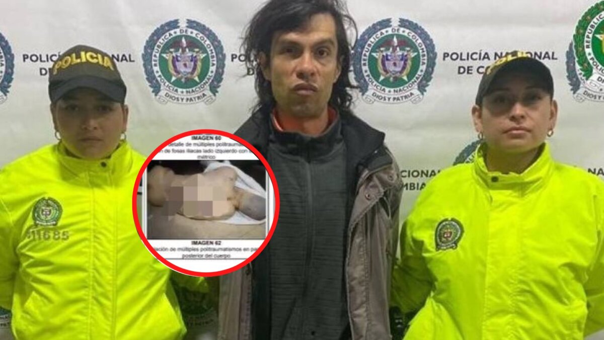 Revelan impactantes fotografías del cadáver de Juan Pablo González Juan Pablo González, señalado de abusar de una menor de edad en TransMilenio, recibió una brutal golpiza en las celdas de la URI Puente Aranda, la cual quedó plasmada en su piel.
