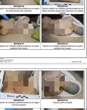 Revelan impactantes fotografías del cadáver de Juan Pablo González Juan Pablo González, señalado de abusar de una menor de edad en TransMilenio, recibió una brutal golpiza en las celdas de la URI Puente Aranda, la cual quedó plasmada en su piel.