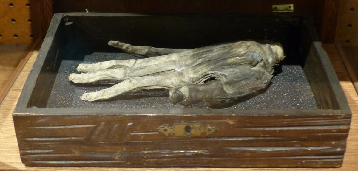 Los macabros poderes de la mano de gloria 1 Los macabros poderes de la mano de gloria En el mundo paranormal abundan los amuletos y las historias alrededor de ellos, pero ninguno como la mano de gloria, muy popular en el siglo XVI entre los ladrones para poder cometer sus delitos sin que nadie los descubriera.