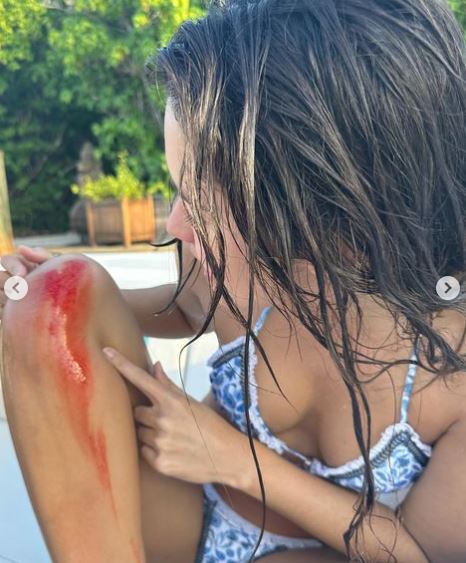 Paulina Vega se accidentó en pleno paseo 1 Paulina Vega se accidentó en pleno paseo La hermosa exreina de belleza Paulina Vega compartió en sus redes sociales que tuvo un accidente en medio de sus lujosas vacaciones en un yate.