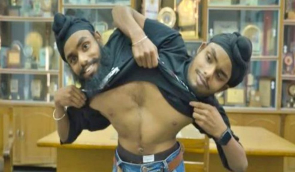 Siameses denuncian que en su trabajo solo reciben un salario Sohna y Mohna Singh, son dos hermanos siameses nacidos en la India que se han vuelto virales en redes sociales en los últimos días.