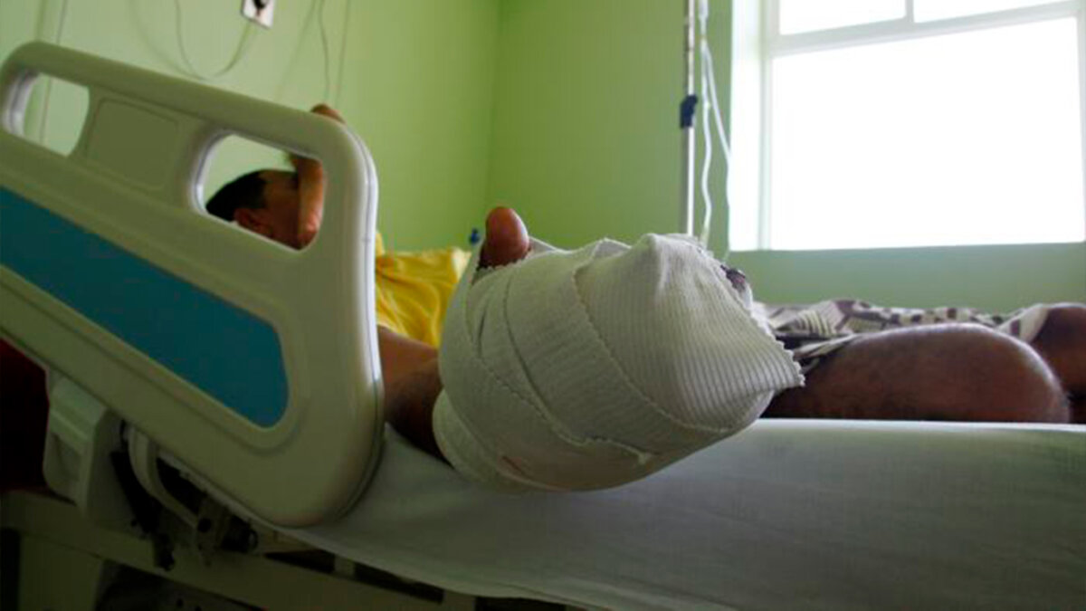 Urgencias en vacaciones: quemados e intoxicados entre los más comunes 4 Urgencias en vacaciones: quemados e intoxicados entre los más comunes En la temporada de fin de año las urgencias no se van de vacaciones, por lo que es común encontrar pacientes intoxicados, ya sea por el consumo de alimentos o la ingesta de licor y sustancias psicoactivas. A ellos se suman los pacientes quemados por pólvora.
